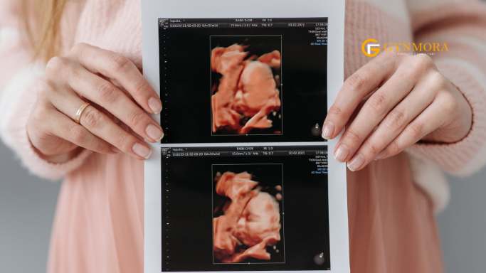 are painful periods a sign of good fertility
