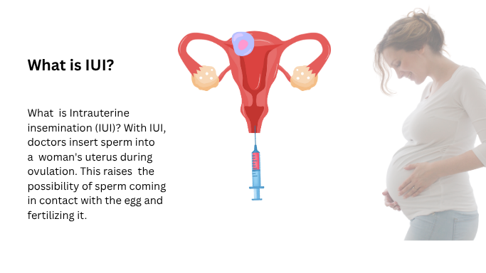How To Improve IUI Success