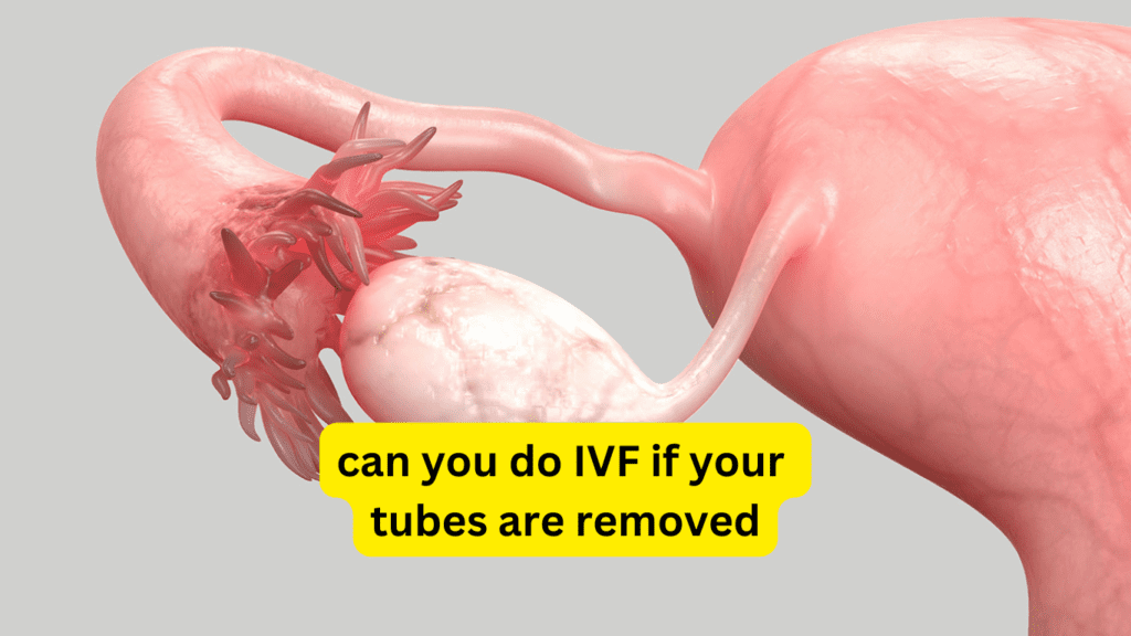 can you do IVF if your tubes are removed