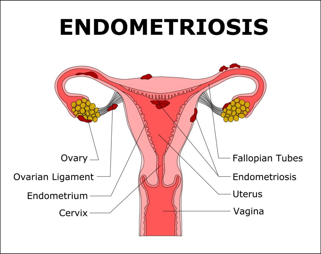 Endometrial Receptivity Array: 7 Must-Know Facts for Your IVF Journey