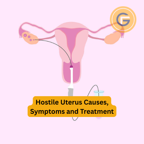Hostile Uterus