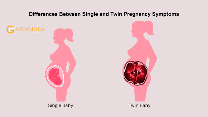 HCG Twin Levels