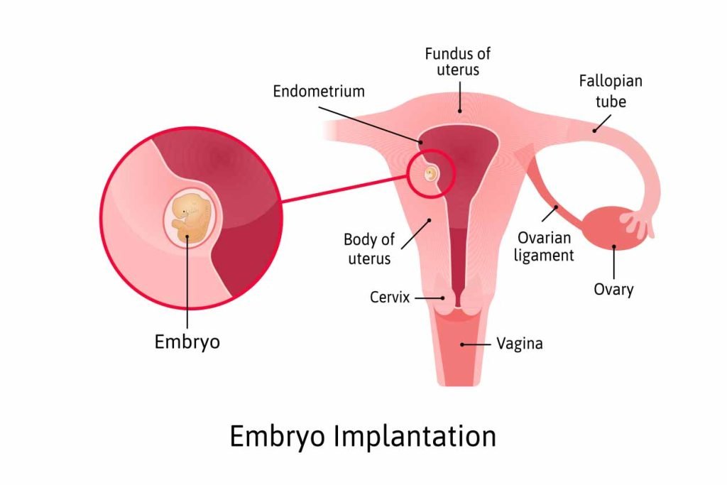 Endometrial Receptivity Array: 7 Must-Know Facts for Your IVF Journey